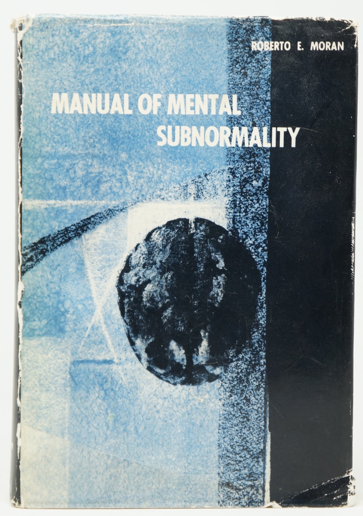 Subnormality Depression Manual of Mental Subnormality: Its Causes, Treatment and Prevention ...