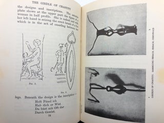 The Girdle of Chastity: A Medico-Historical Study